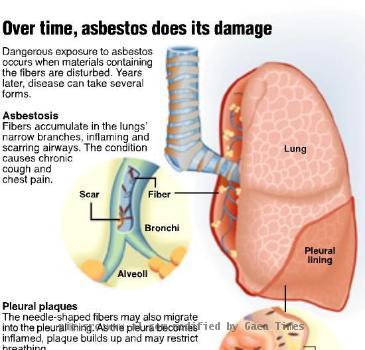 mesothelioma attorney virginia